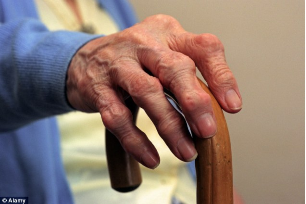 Why Arthritis Is Common in Older People: Here Are the Reasons